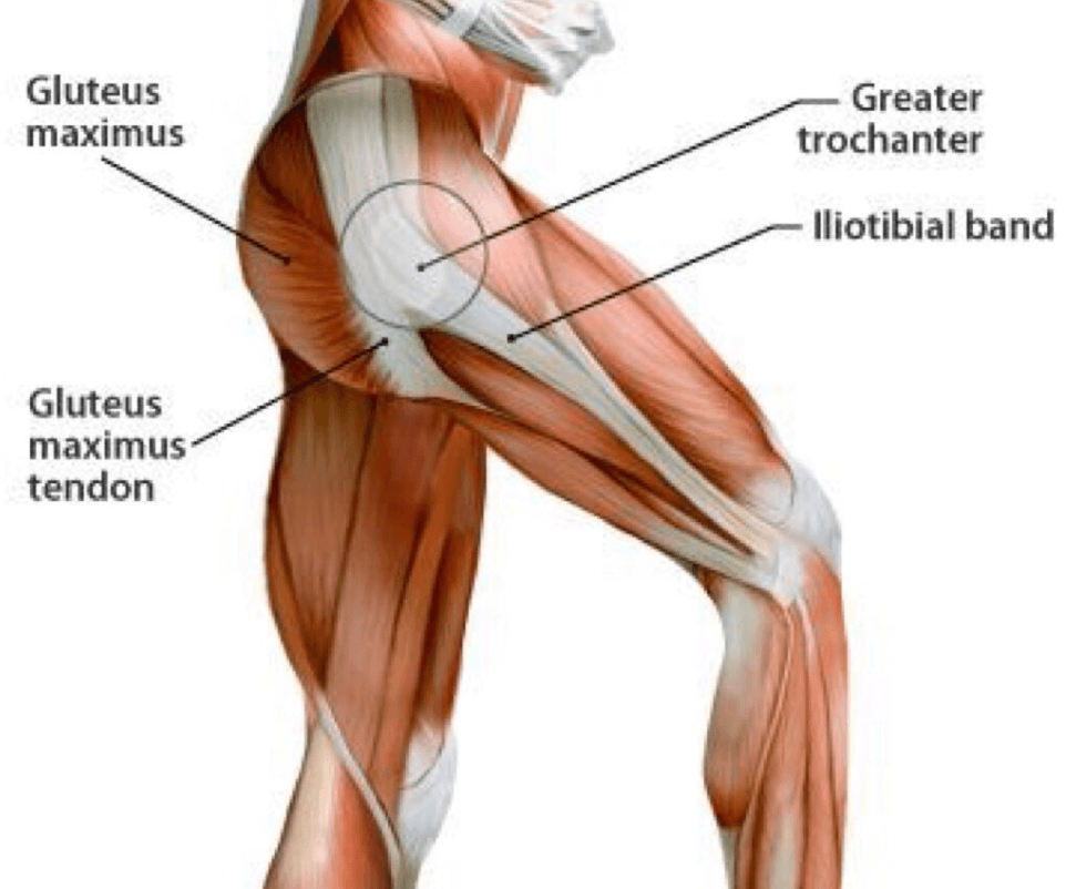 Hip Bursitis